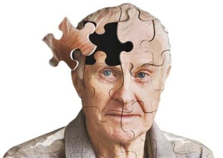 بررسی تاثیر استرس بر ابتلا به آلزایمر