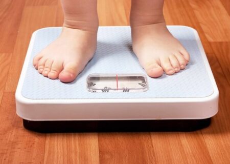 شایع‌ترین علل چاقی کودکان